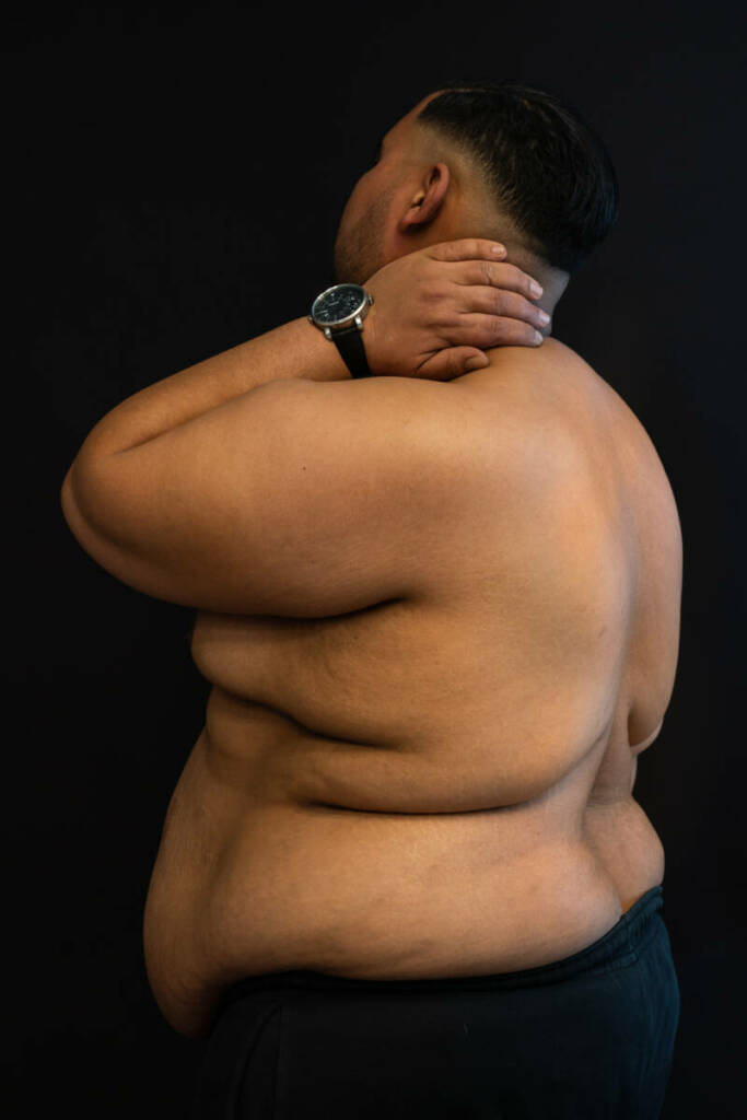 Le corps gros : Hamza Photographie thérapeutique d
